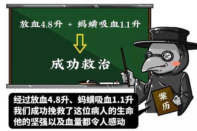 只有中医有偏方？中世纪欧洲的医术更让人不忍直视-11.jpg