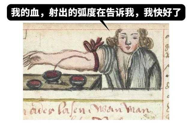 只有中医有偏方？中世纪欧洲的医术更让人不忍直视-8.jpg