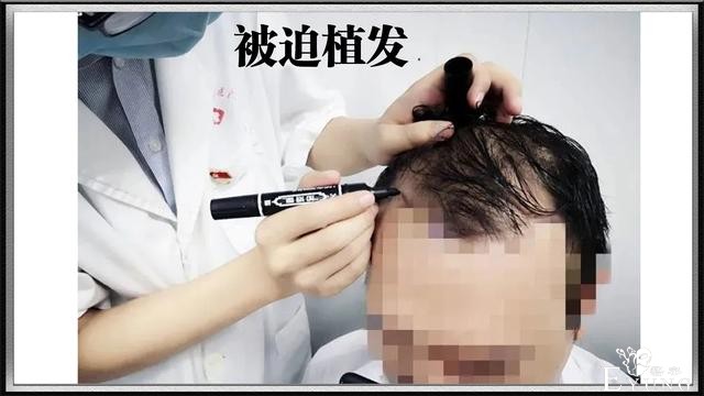 一拳超人：过度训练会像琦玉一样变光头吗？事实证明“会”-4.jpg