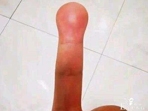 网友自称手指被砸，发文吐槽：《猫和老鼠》果然没骗我-1.jpg