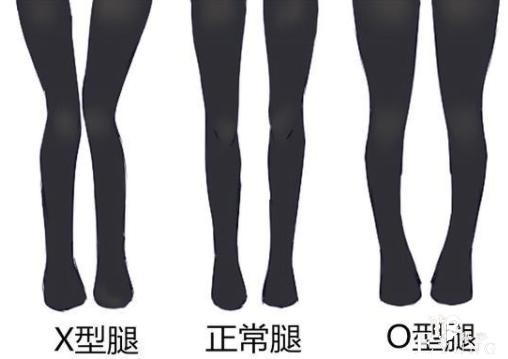 动漫妹子的腿被吐槽，说人家罗圈腿X形腿，是作业太少了么-2.jpg