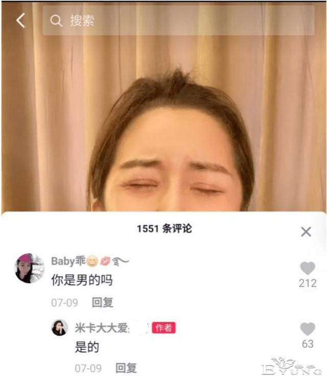 男网红整容后变伪娘，撞脸杨紫，称脸上有很多钛合钉过安检都会响-7.jpg