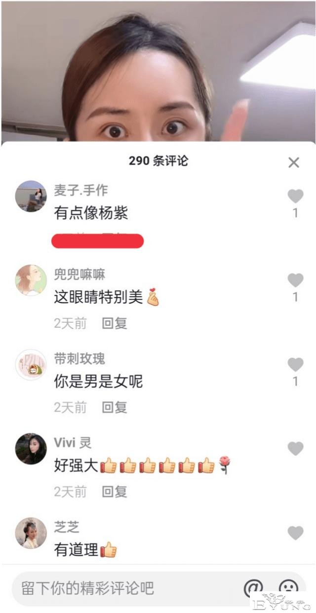 男网红整容后变伪娘，撞脸杨紫，称脸上有很多钛合钉过安检都会响-10.jpg