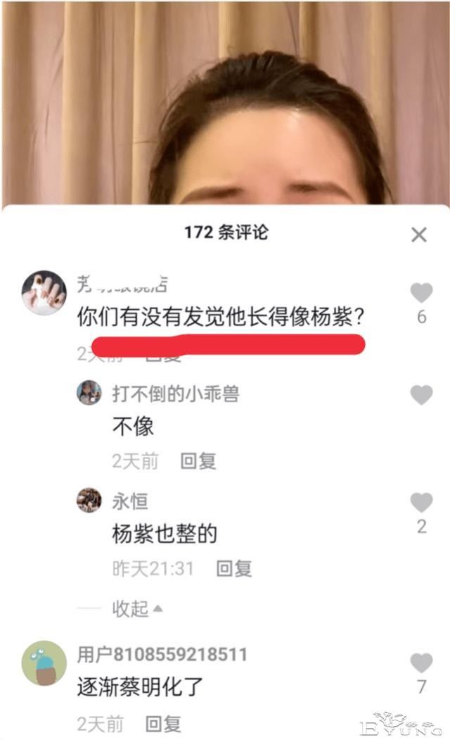 男网红整容后变伪娘，撞脸杨紫，称脸上有很多钛合钉过安检都会响-9.jpg