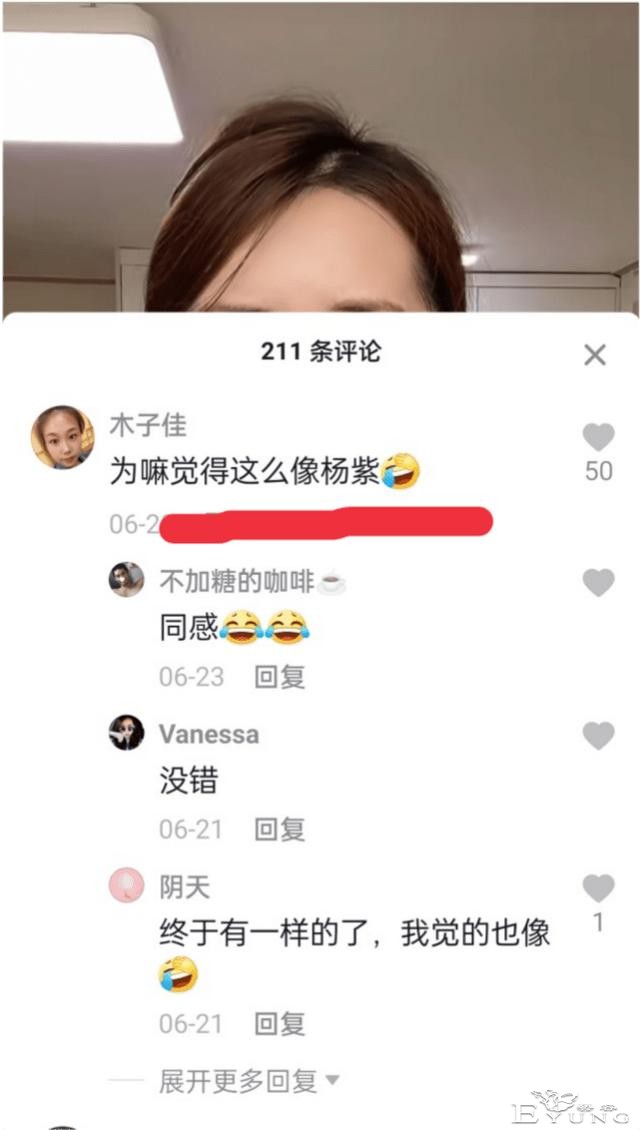 男网红整容后变伪娘，撞脸杨紫，称脸上有很多钛合钉过安检都会响-8.jpg