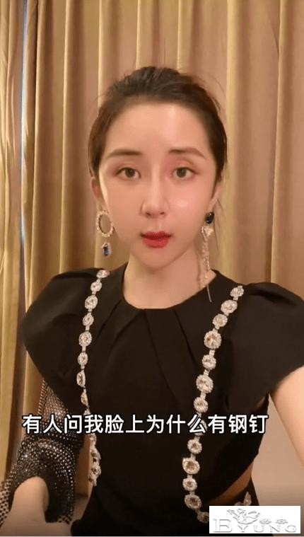 男网红整容后变伪娘，撞脸杨紫，称脸上有很多钛合钉过安检都会响-12.jpg