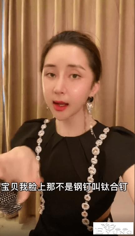男网红整容后变伪娘，撞脸杨紫，称脸上有很多钛合钉过安检都会响-13.jpg