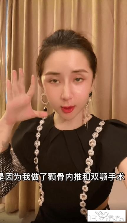 男网红整容后变伪娘，撞脸杨紫，称脸上有很多钛合钉过安检都会响-14.jpg
