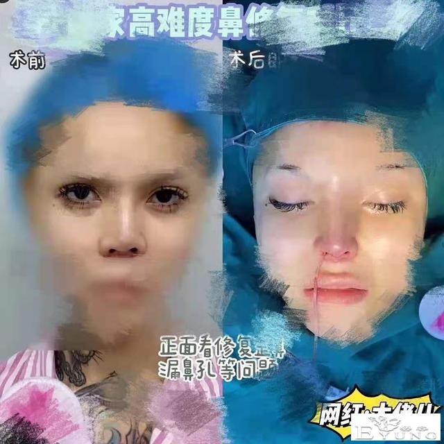 知名美女网红被曝是男生！疑原声视频流出，自称为整容花费几套房-15.jpg