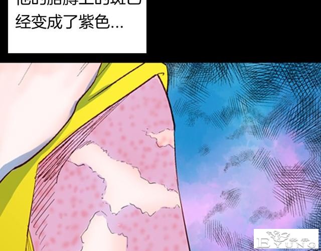 讽刺漫画《皮肤病患者》，被我不放在心上的病人，竟然这么严重？-3.jpg