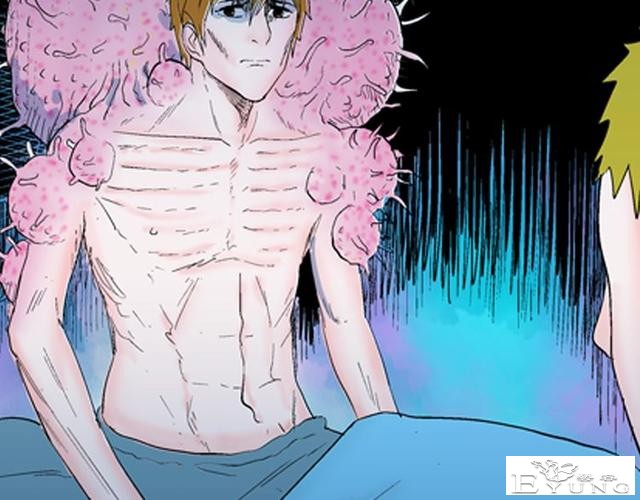 讽刺漫画《皮肤病患者》，被我不放在心上的病人，竟然这么严重？-49.jpg