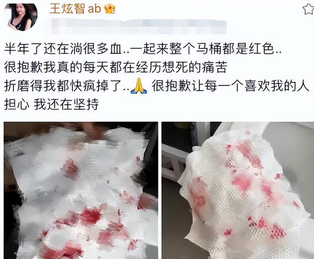 回顾：网红艾比变性后哭诉：每天都在经历痛苦，手术半年还在流血-5.jpg